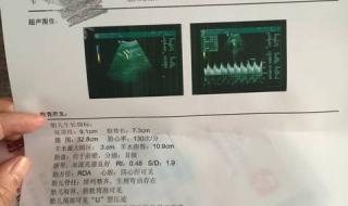 胎儿双顶径标准 胎儿双顶径标准